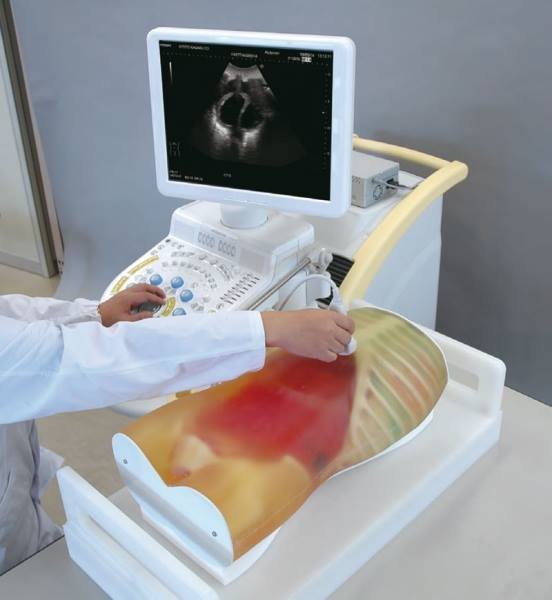 FAST Ultrasound training model